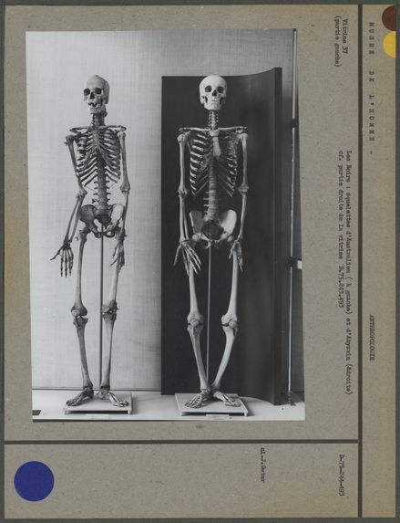 Les Noirs : squelettes d'Australiens et d'Abyssin