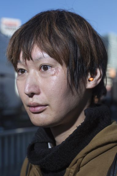 Portrait of a woman with traces of surgery, Tokyo