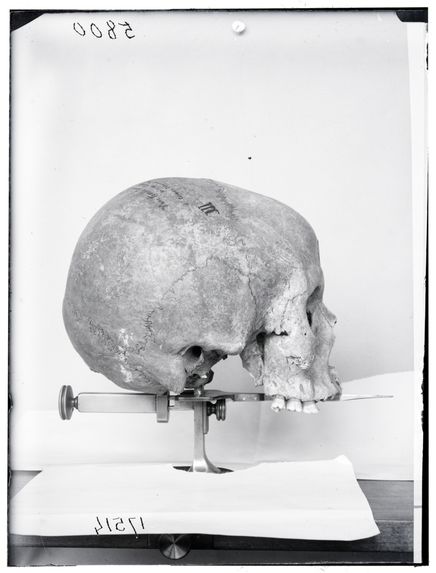 Crâne de romain de Corneto-Tarquinia